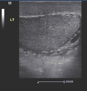 Ultrasound image of left testis in ls
